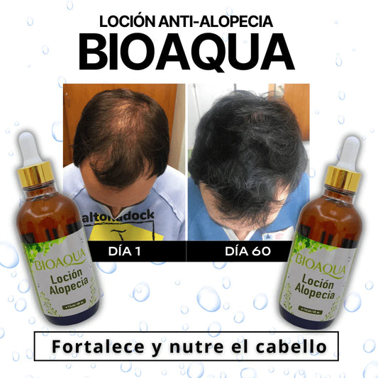 Loción Anti-Alopecia BIOAQUA